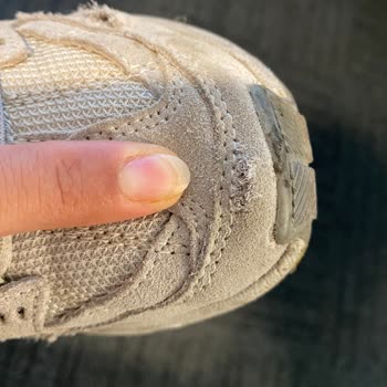 Kısa Sürede Deforme Olan Skechers Ayakkabılar Hayal Kırıklığı Yarattı
