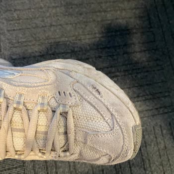 Kısa Sürede Deforme Olan Skechers Ayakkabılar Hayal Kırıklığı Yarattı