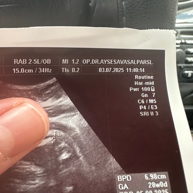 Randevu Saatine Uyulmadı Doktor Öğle Arasına Çıktı Sıra Beklemekten Şikayetçiyim