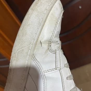 3 Ayda Deforme Olan Ayakkabı, İlgisiz Satıcı Ve Mağdur Müşteri