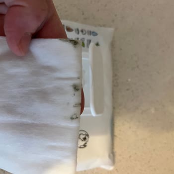 Son Kullanma Tarihi Geçmemiş Sleepy Islak Mendillerde Küf Ve Cilt Sorunu