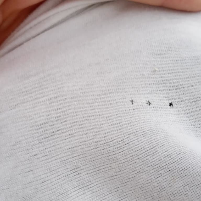 Grundig Çamaşır Makinesi Kıyafetleri Deliyor, Sürekli Arıza Yaşıyorum