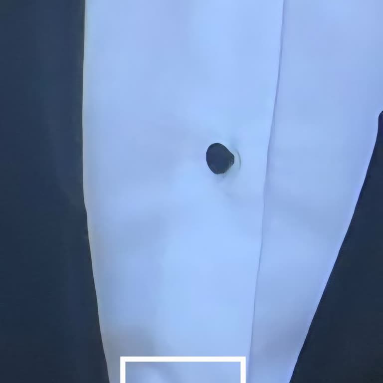 Kusurlu Gömlek Ve Yetersiz Satış Sonrası Hizmet