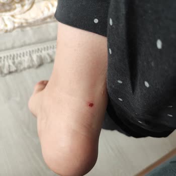 Skechers Ürününde Yaşanan Sorun Ve Değişim Talebinin Reddedilmesi