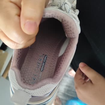 Skechers Ürününde Yaşanan Sorun Ve Değişim Talebinin Reddedilmesi