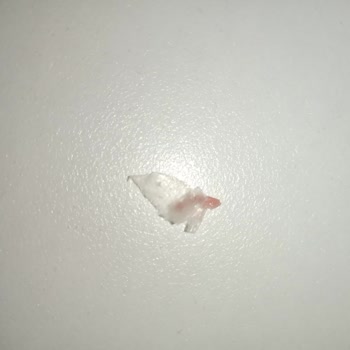 Sosisin İçinden Plastik Parçası Çıktı: Sağlığımız Tehlikede!