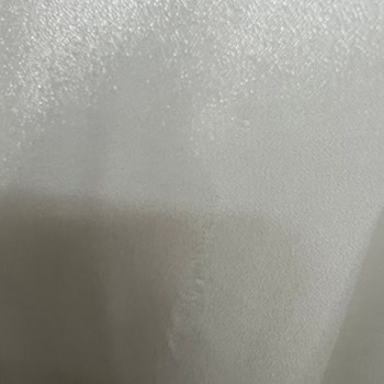 Kuru Temizleme Sonrası Gelinlikte Hasar Ve İlgisiz Firma Yaklaşımı