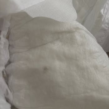 Bebek Bezinde Beklenmedik Yabancı Madde Şoku