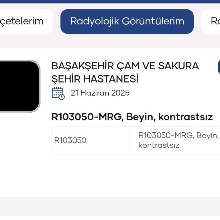 MR Sonuçlarının 11 Gündür Çıkmaması Ve İletişim Eksikliği