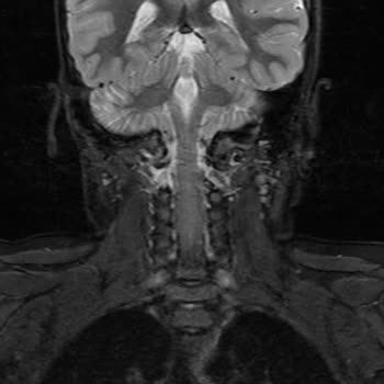 Çocuğumun Ameliyatı Sonrası Sorunlar Devam Ediyor, Memnun Kalmadık