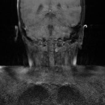 Çocuğumun Ameliyatı Sonrası Sorunlar Devam Ediyor, Memnun Kalmadık