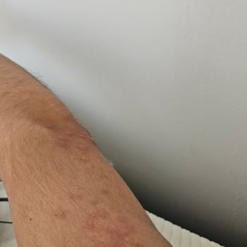 Mevlana Otel (Konya) Hijyen Yok