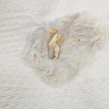 Siparişimden Kemik Parçası Çıkması Nedeniyle Hayal Kırıklığı Yaşadım