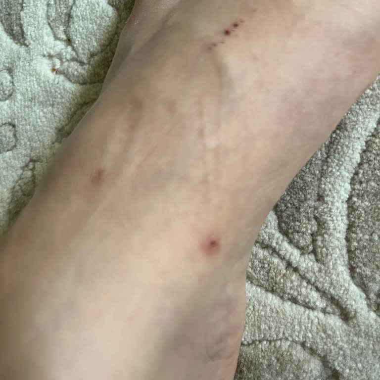 Evde Giyilen Terlik Ayaklarımı Yaraladı İade Kabul Edilmedi