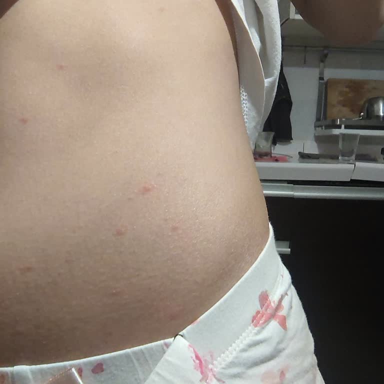 Deneme Kabinlerinde Hijyen Eksikliği Sağlığımı Tehlikeye Attı