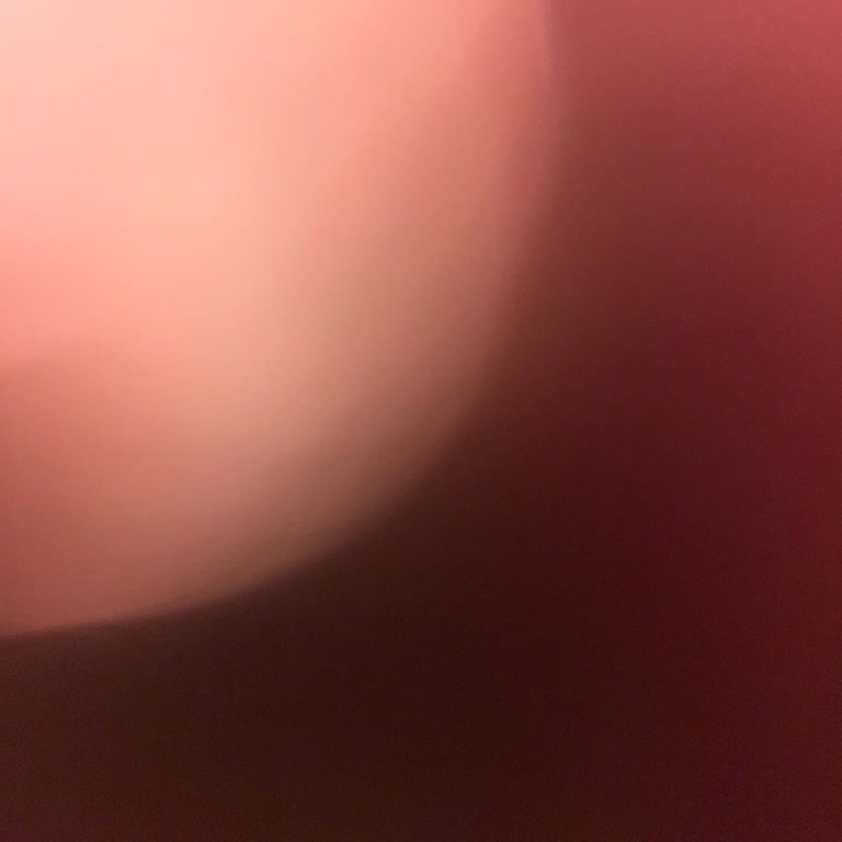 Erken Teslimat Ve Hediye Taahhüdünde Sorun Yaşadım