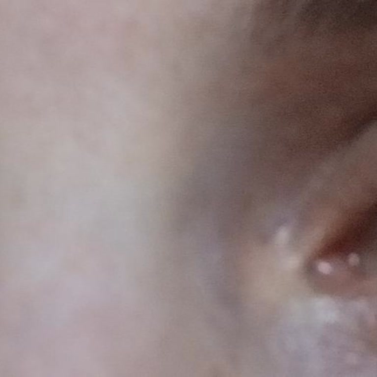 Kirpik Uygulaması Sonrası Yaşanan Sorunlar Ve Ücret İadesi Süreci