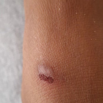 Aldığım Terlik Ayağımı Yaralıyor, Değişim Veya İade Talep Ediyorum