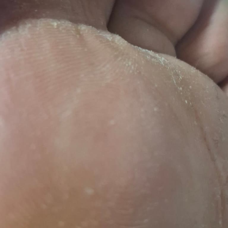 Aldığım Terlik Ayağımı Yaralıyor, Değişim Veya İade Talep Ediyorum