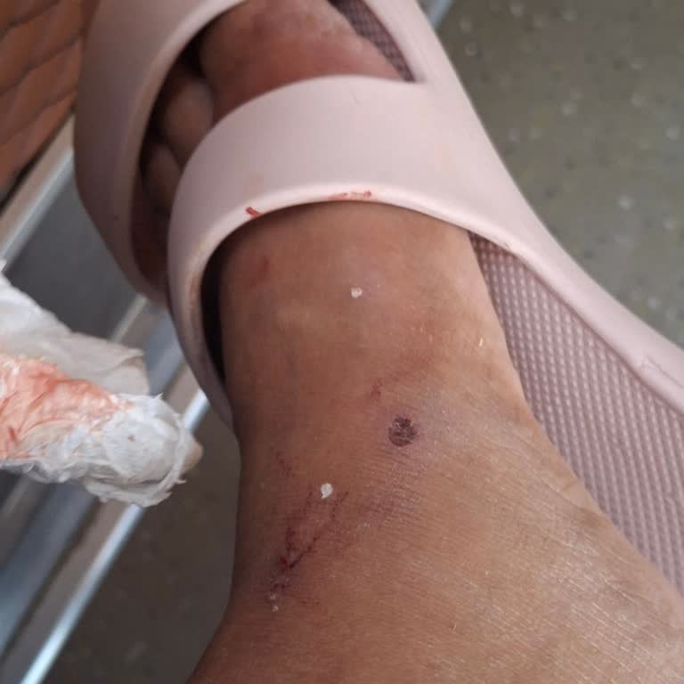 Aldığım Terlik Ayağımı Yaralıyor, Değişim Veya İade Talep Ediyorum