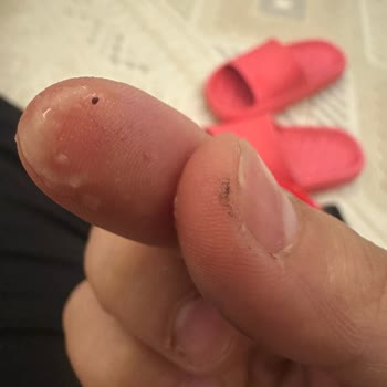 Hero Baby Tahıllı Rezeneli Mamadan Siyah Parçalar Çıktı, Güvenim Sarsıldı