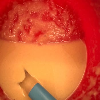 Hero Baby Tahıllı Rezeneli Mamadan Siyah Parçalar Çıktı, Güvenim Sarsıldı