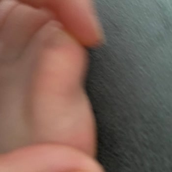 Ayakkabı Kullanımı Sonrası Kızımın Ayağında Yaralar Oluştu