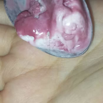 Dondurma İçinden Kıl Çıkması Ve Hayal Kırıklığı