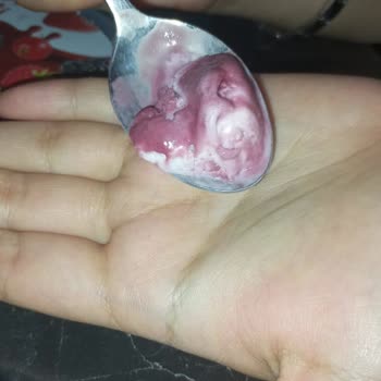 Dondurma İçinden Kıl Çıkması Ve Hayal Kırıklığı