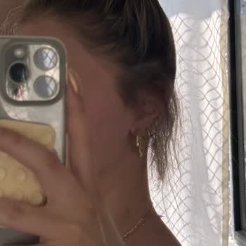 Kuaför İşlemi Sonrası Ense Saçlarım Yandı Ve Koparak Mağdur Oldum