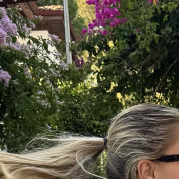 Kuaför İşlemi Sonrası Ense Saçlarım Yandı Ve Koparak Mağdur Oldum