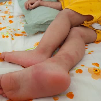 Aldığım Vitamin Ciddi Alerjik Reaksiyona Sebep Oldu