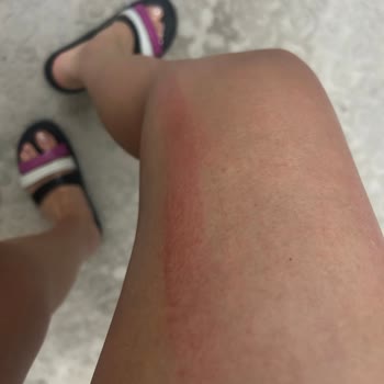 Isana 3 Bıçaklı Jilet Ağrı Ve Cilt Sorununa Yol Açtı