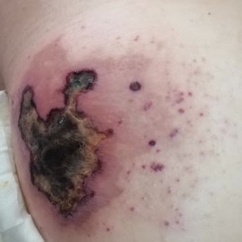 Süleyman Yalçın Şehir Hastanesi Acil Serviste Yanlış İğne ve İlgisizlik Sonrası Artan Sorunlar