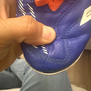 Adidas Ayakkabıda Erken Açılma Ve Garanti Sürecinde İlgisizlik Yaşadım