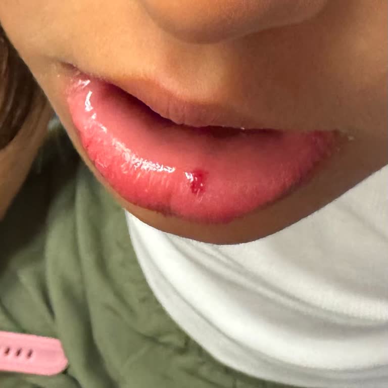 Kirman Calyptus Resort SPA Hotels Güvenlik İletişim Eksikliği Çocuğumun Güvenliğini Tehlikeye Attı