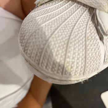 1,5 Ayda Dikişleri Kopan Adidas Ayakkabıma Ret Cevabı