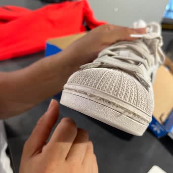 1,5 Ayda Dikişleri Kopan Adidas Ayakkabıma Ret Cevabı