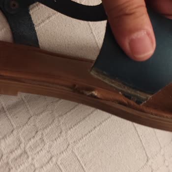 Aldığım Sandaletler Hem Kusurlu Hem Sağlıksız Çıktı