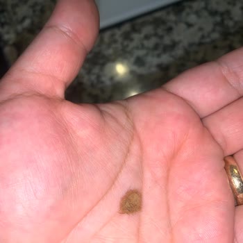 A101'den Alınan Çay Paketinden Yabancı Cisim Çıkması