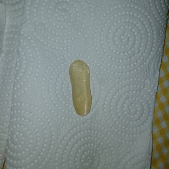 Sushi Siparişimde Yabancı Cisim Buldum Mide Bulantısı Yaşadım