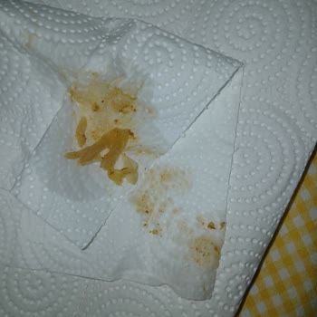 Sushi Siparişimde Yabancı Cisim Buldum Mide Bulantısı Yaşadım