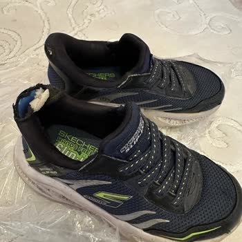 Ayakkabıda Deformasyon Sonrası Garanti Sorunu Yaşadık