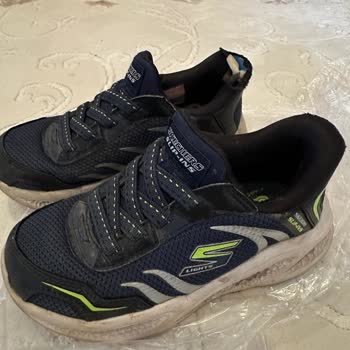 Ayakkabıda Deformasyon Sonrası Garanti Sorunu Yaşadık