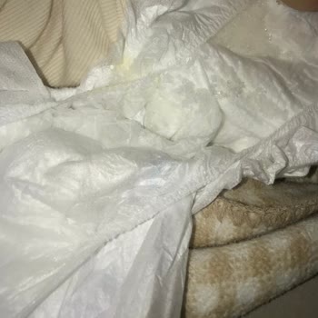 Molfix 3 Numara Bebek Bezlerinde Sürekli Yırtık Ve Dağılma Sorunu