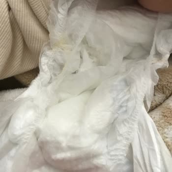 Molfix 3 Numara Bebek Bezlerinde Sürekli Yırtık Ve Dağılma Sorunu