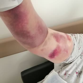 Radyoloji Bölümünde İlgisizlik Ve Mağduriyet