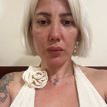 Calvin Clinic'te Yapılan Botox Sonrası Yüz Felci Ve Görme Kaybı Yaşadım