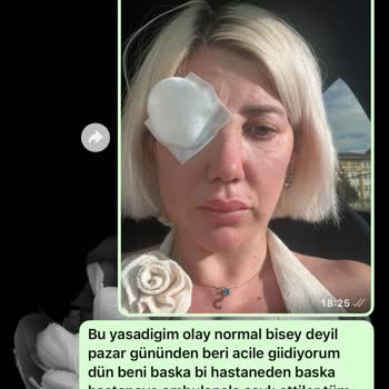 Calvin Clinic'te Yapılan Botox Sonrası Yüz Felci Ve Görme Kaybı Yaşadım