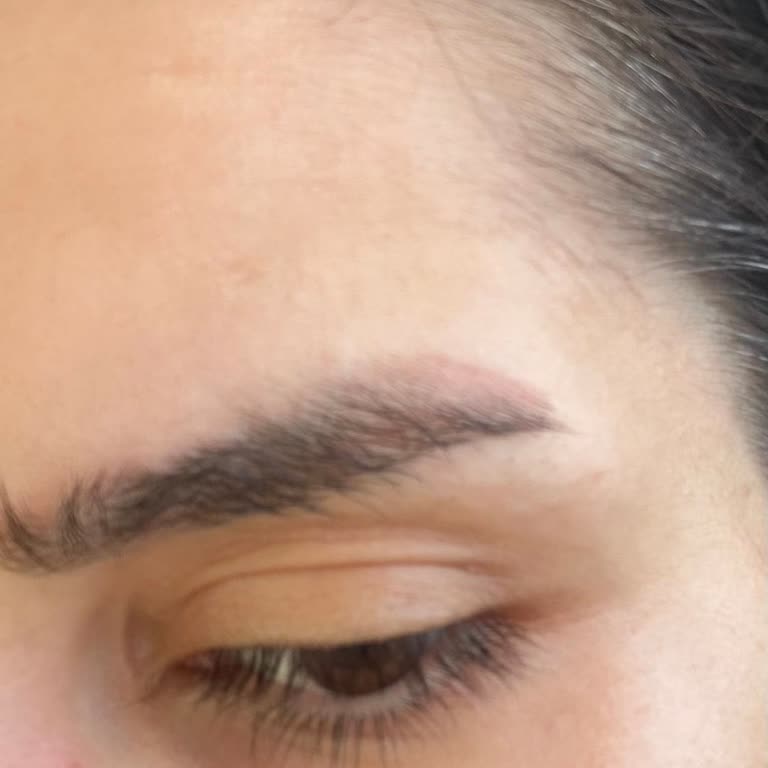 Microblading Boyası Yıllardır Çıkmıyor, Şekli De Kötü